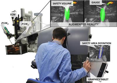 EnViSoRS: Enhanced Vision System for Robotic Surgery. A User-Defined Safety Volume Tracking to Minimize the Risk of Intraoperative Bleeding